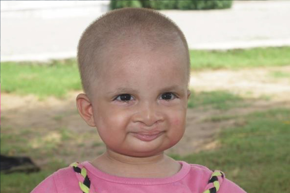 Kainat smiles after cleft lip surgery