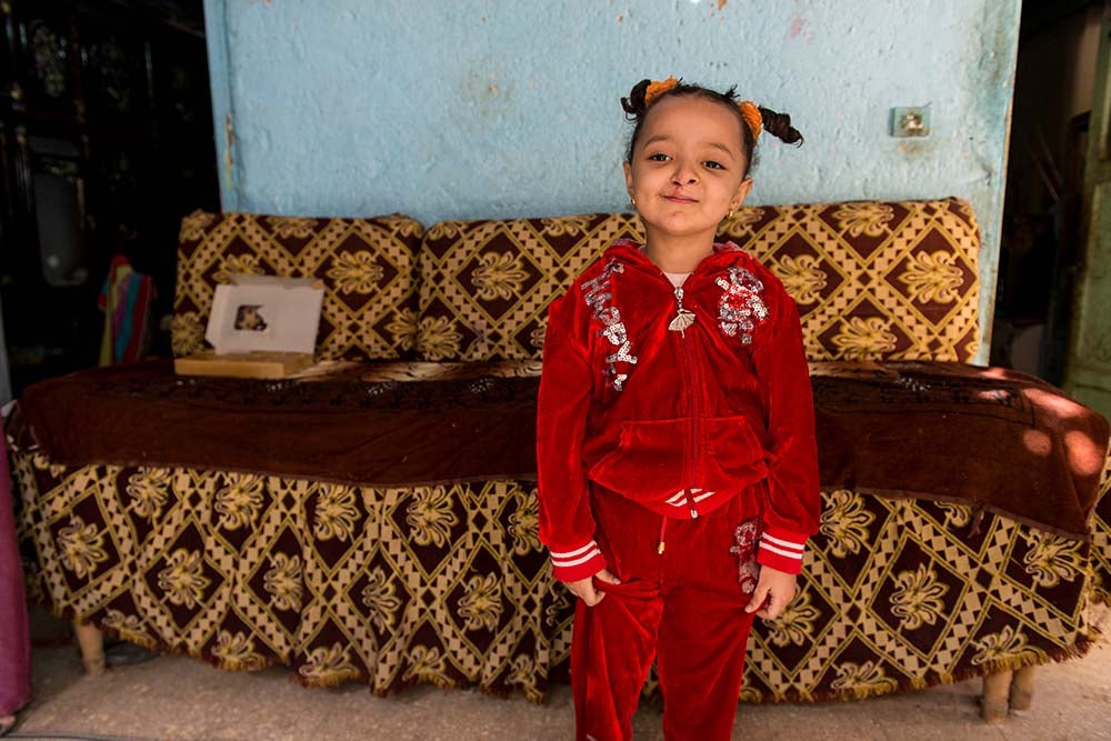 Esraa at home after cleft surgery