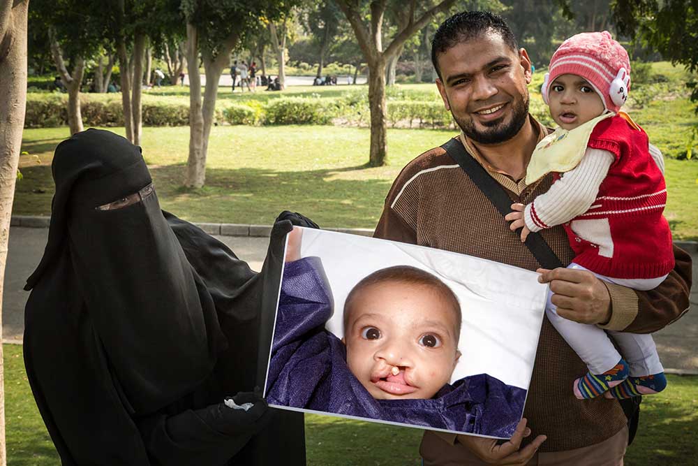 Habeeba's family holds image of her before cleft surgery