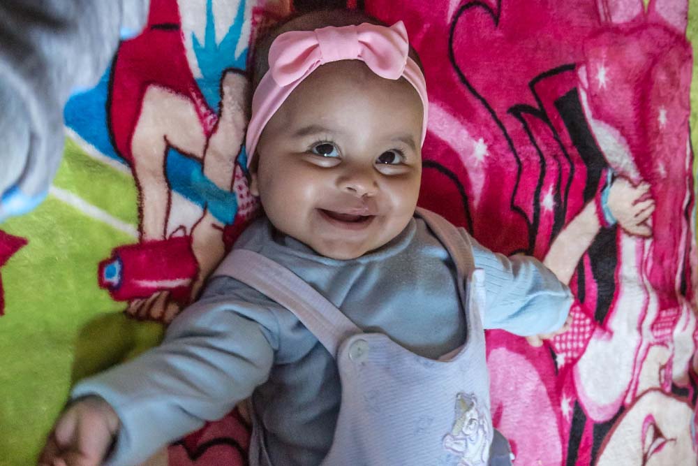 Roaa on the bed after cleft surgery