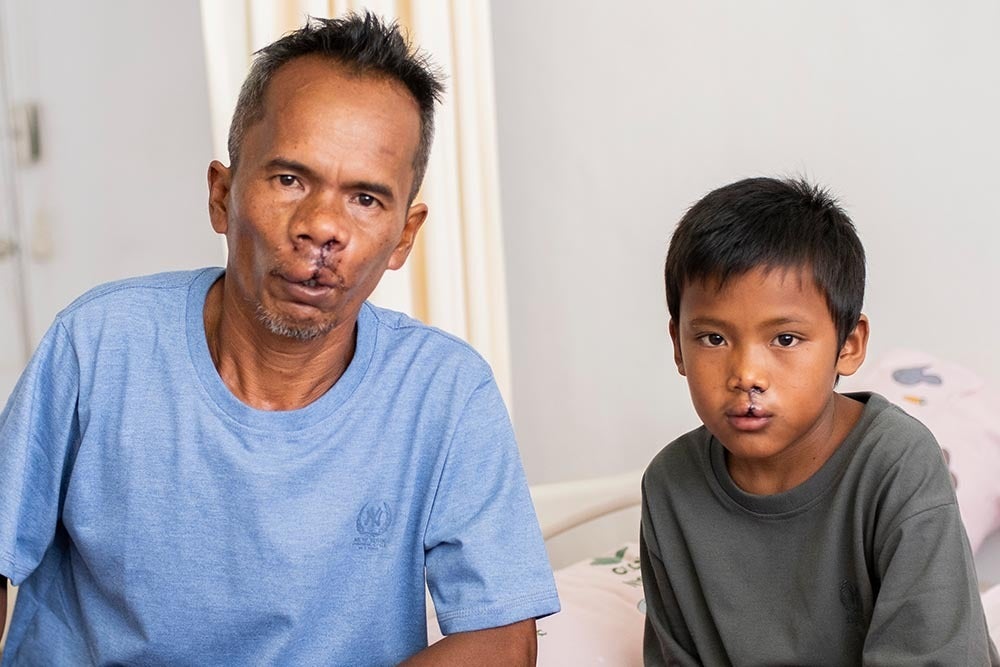 Father and son Alim and Rajib - Smile Train's 2,000,000 and 2,000,001 cleft surgeries.