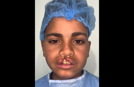 Mohamed before sugery