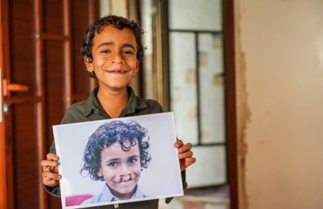 Bilal smiling and holding a picture of himself before cleft surgery