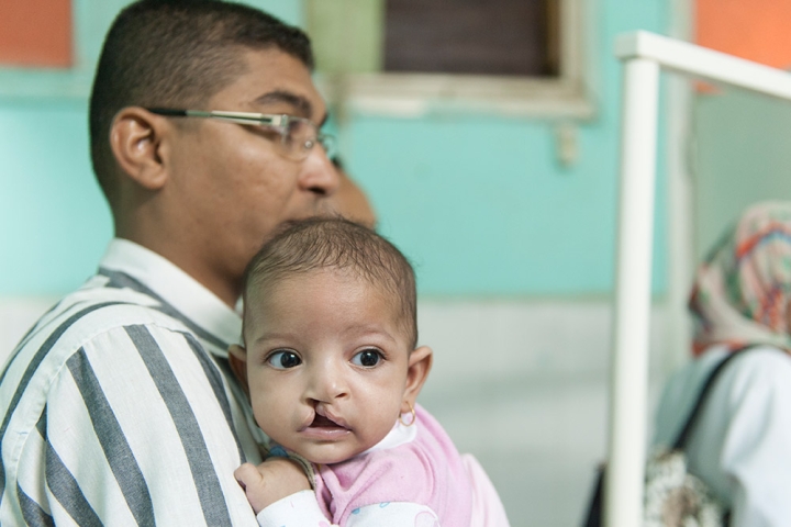 Baby with cleft lip being held by father