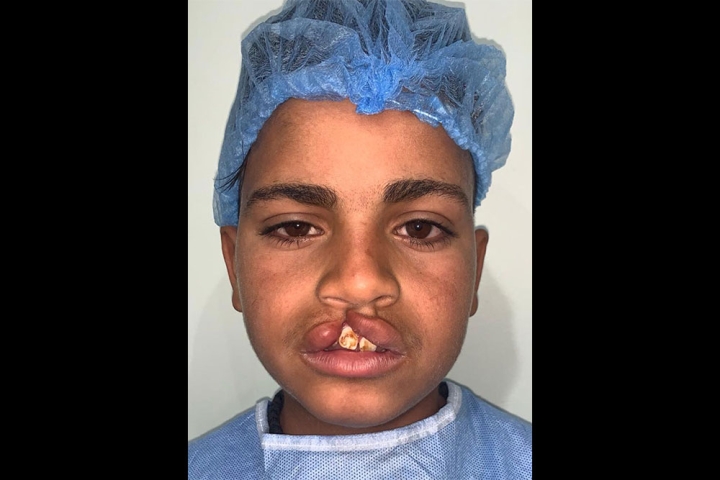 Mohamed before sugery